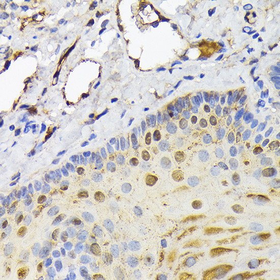 FABP5 Antibody in Immunohistochemistry (Paraffin) (IHC (P))