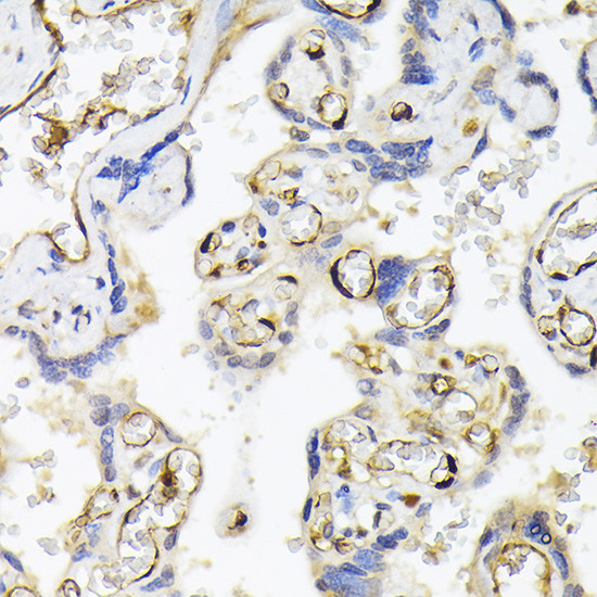 FABP5 Antibody in Immunohistochemistry (Paraffin) (IHC (P))