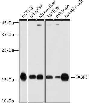 FABP5 Antibody in Western Blot (WB)