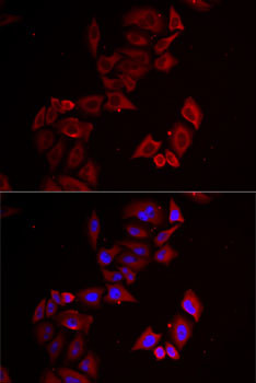 LIMS1 Antibody in Immunocytochemistry (ICC/IF)