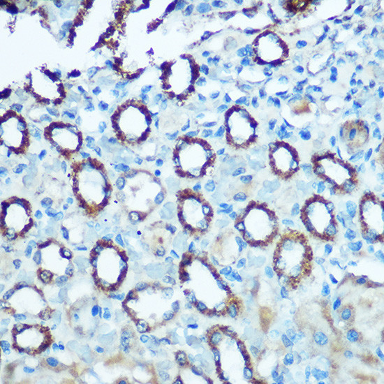 NDUFS4 Antibody in Immunohistochemistry (Paraffin) (IHC (P))