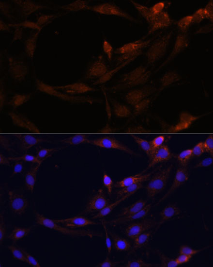 SERPINB9 Antibody in Immunocytochemistry (ICC/IF)