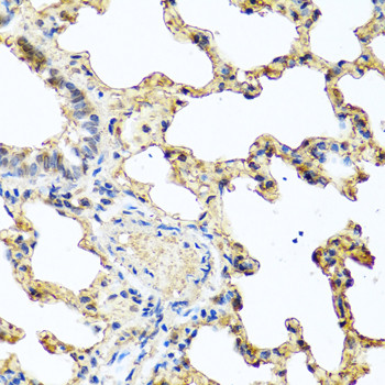 GCDFP-15 Antibody in Immunohistochemistry (Paraffin) (IHC (P))