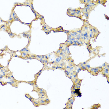 GCDFP-15 Antibody in Immunohistochemistry (Paraffin) (IHC (P))