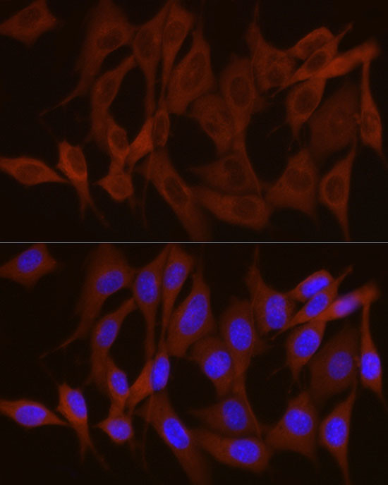 GPBB Antibody in Immunocytochemistry (ICC/IF)