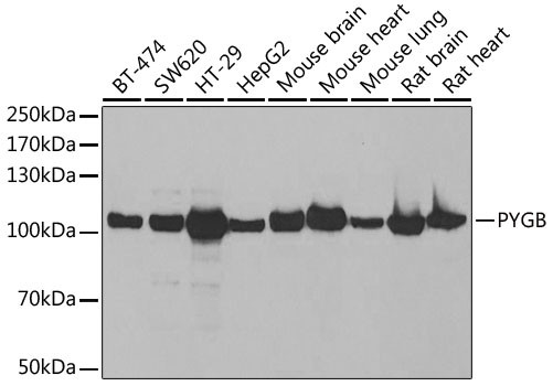 GPBB Antibody in Western Blot (WB)