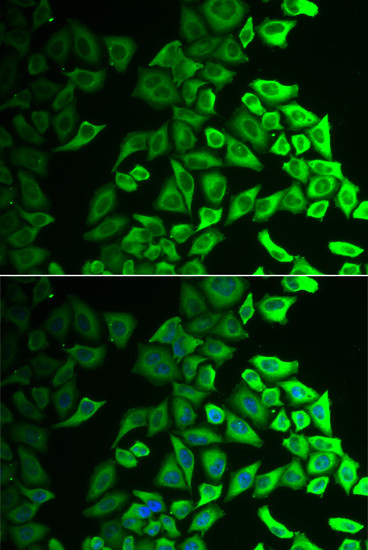 IL18BP Antibody in Immunocytochemistry (ICC/IF)