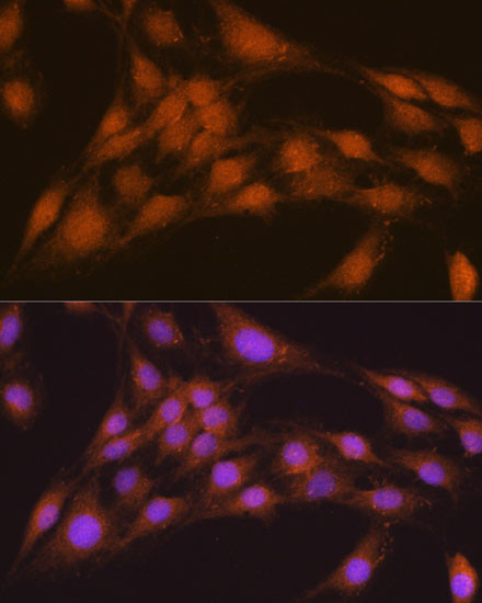 NRBF2 Antibody in Immunocytochemistry (ICC/IF)