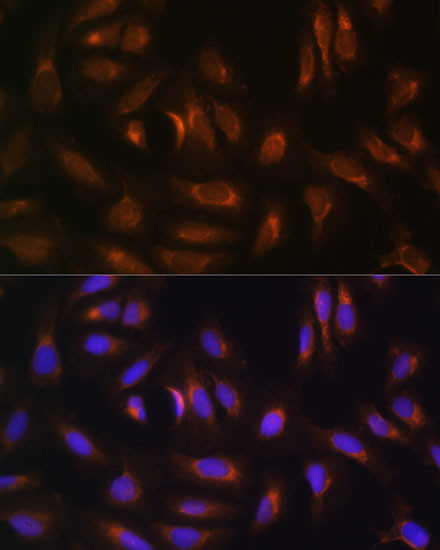 NRBF2 Antibody in Immunocytochemistry (ICC/IF)