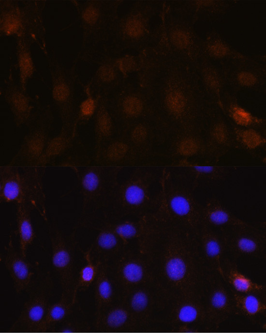 NRBF2 Antibody in Immunocytochemistry (ICC/IF)