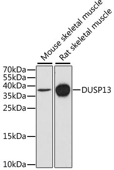 DUSP13 Antibody in Western Blot (WB)