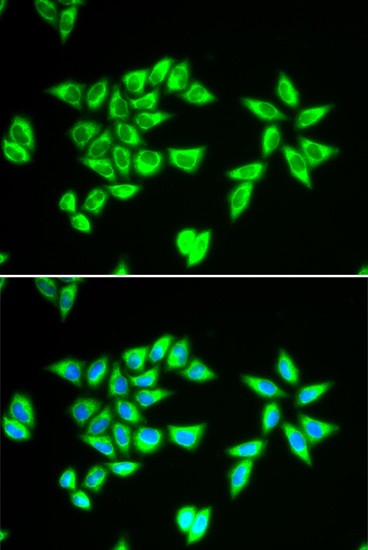 Bit1 Antibody in Immunocytochemistry (ICC/IF)