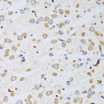 Bit1 Antibody in Immunohistochemistry (Paraffin) (IHC (P))