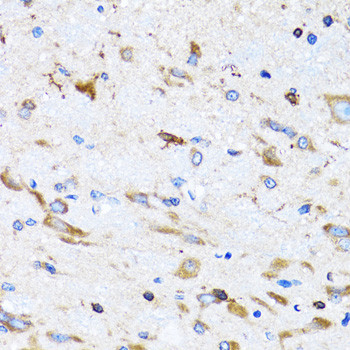 Bit1 Antibody in Immunohistochemistry (Paraffin) (IHC (P))