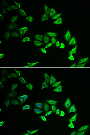 MYOZ2 Antibody in Immunocytochemistry (ICC/IF)