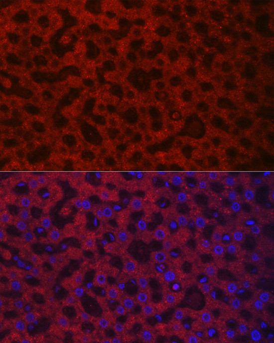 HAO1 Antibody in Immunocytochemistry (ICC/IF)