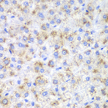 HAO1 Antibody in Immunohistochemistry (Paraffin) (IHC (P))