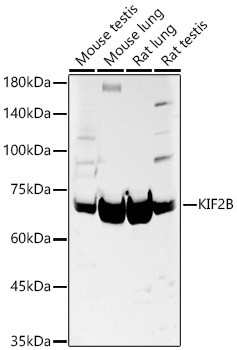 KIF2B Antibody in Western Blot (WB)