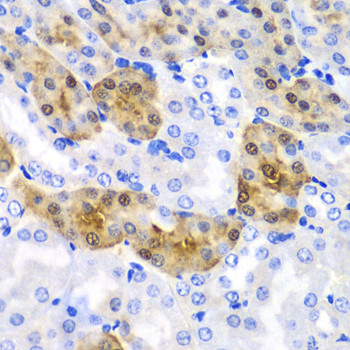 HPD Antibody in Immunohistochemistry (Paraffin) (IHC (P))