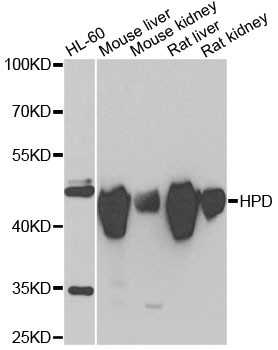 HPD Antibody in Western Blot (WB)