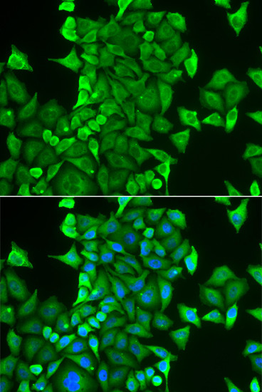 CARS Antibody in Immunocytochemistry (ICC/IF)