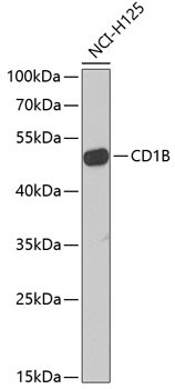 CD1b Antibody in Western Blot (WB)