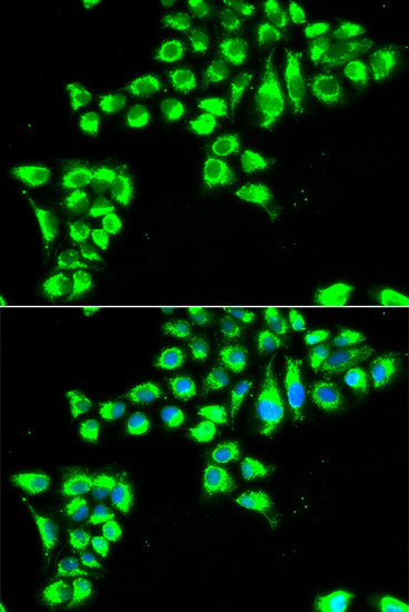 Claudin 2 Antibody in Immunocytochemistry (ICC/IF)