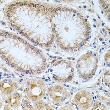 Carboxypeptidase M Antibody in Immunohistochemistry (Paraffin) (IHC (P))