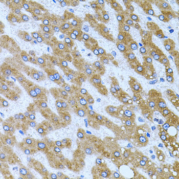 Carboxypeptidase M Antibody in Immunohistochemistry (Paraffin) (IHC (P))