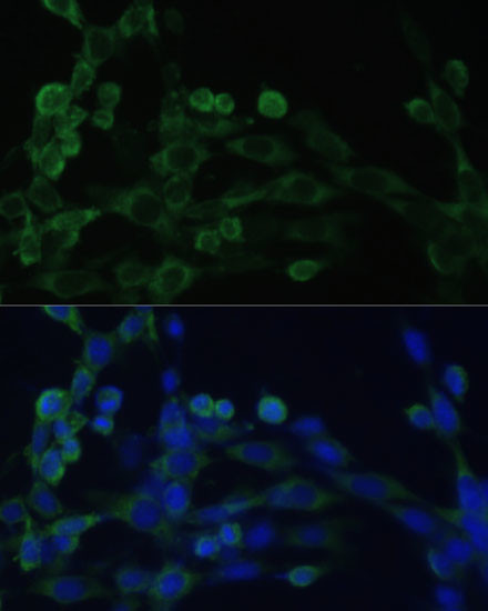 EEF1B2 Antibody in Immunocytochemistry (ICC/IF)