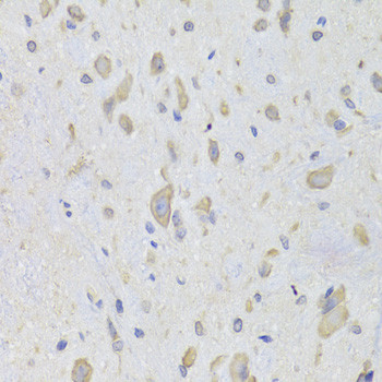 EEF1B2 Antibody in Immunohistochemistry (Paraffin) (IHC (P))