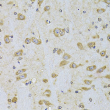 EEF1B2 Antibody in Immunohistochemistry (Paraffin) (IHC (P))