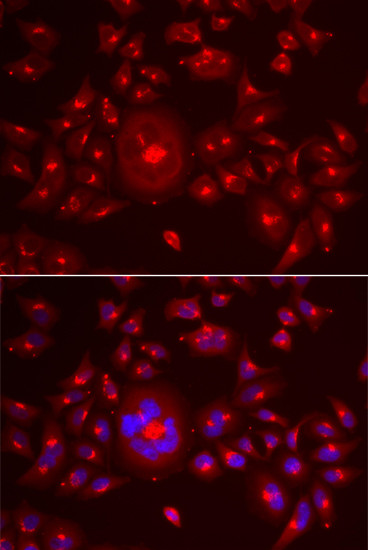 GRASP65 Antibody in Immunocytochemistry (ICC/IF)