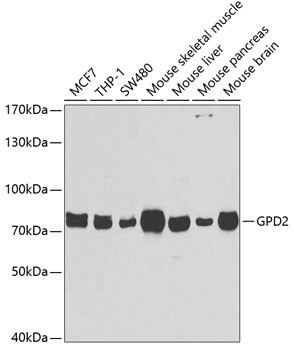 GPD2 Antibody in Western Blot (WB)