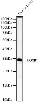 HOXB1 Antibody in Western Blot (WB)