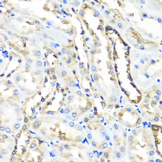 HYAL1 Antibody in Immunohistochemistry (Paraffin) (IHC (P))