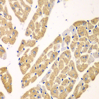 KYNU Antibody in Immunohistochemistry (Paraffin) (IHC (P))