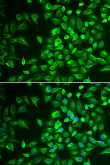 LRAT Antibody in Immunocytochemistry (ICC/IF)