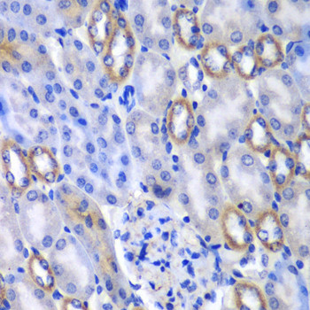 MATK Antibody in Immunohistochemistry (Paraffin) (IHC (P))