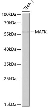 MATK Antibody in Western Blot (WB)