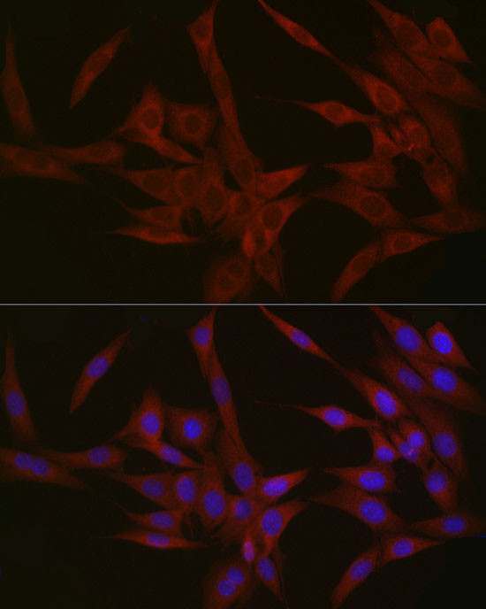 NPHP1 Antibody in Immunocytochemistry (ICC/IF)