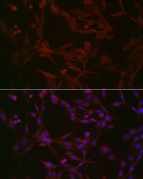 NPHP1 Antibody in Immunocytochemistry (ICC/IF)