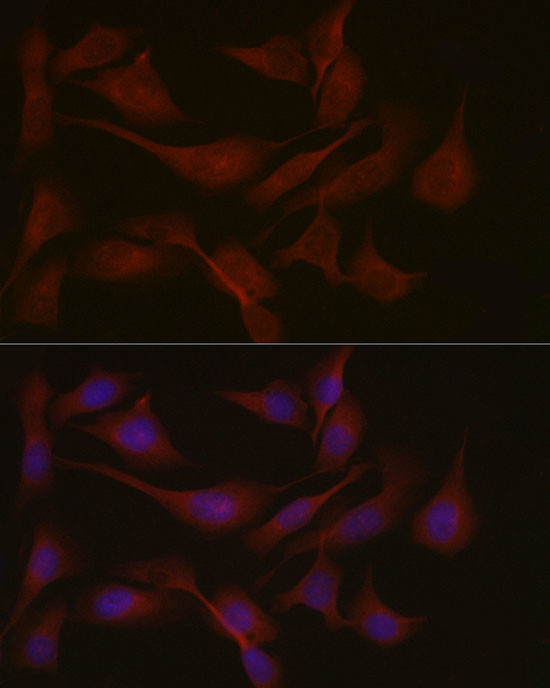 NPHP1 Antibody in Immunocytochemistry (ICC/IF)