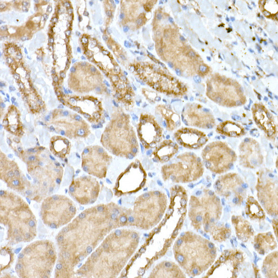 NPHP1 Antibody in Immunohistochemistry (Paraffin) (IHC (P))