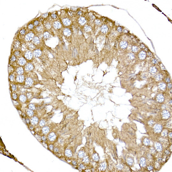 NPHP1 Antibody in Immunohistochemistry (Paraffin) (IHC (P))