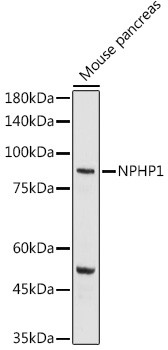 NPHP1 Antibody in Western Blot (WB)