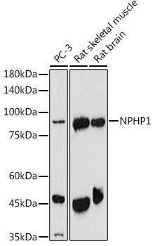 NPHP1 Antibody in Western Blot (WB)