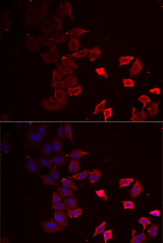 P2X4 Antibody in Immunocytochemistry (ICC/IF)