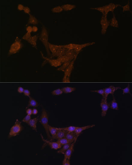 PPAT Antibody in Immunocytochemistry (ICC/IF)