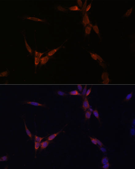 PP2A alpha Antibody in Immunocytochemistry (ICC/IF)